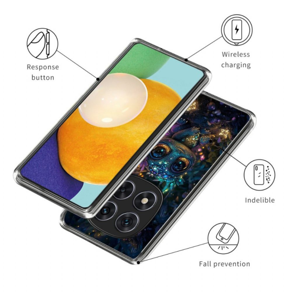 Case Hoesje Xiaomi Redmi Note 14 Pro 4g Telefoonhoesje Elf